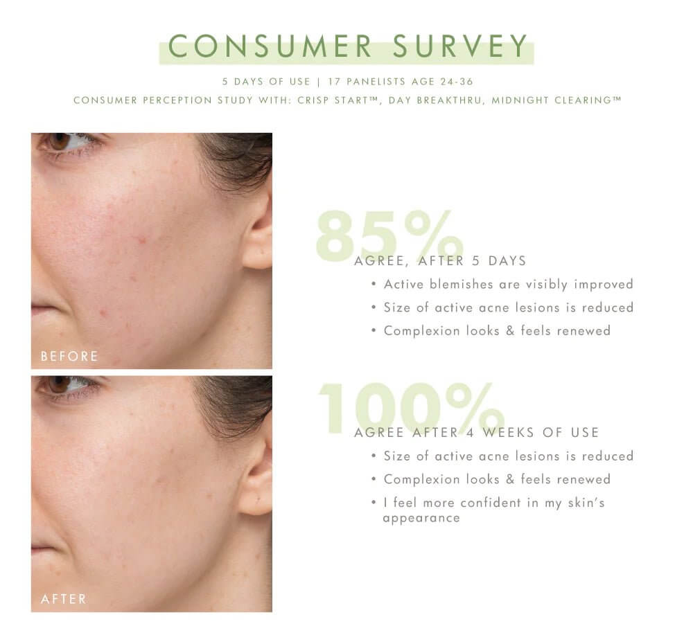 Comeback Clear Rapid Relief Acne Kit | FarmHouse Fresh - Lavender Hills BeautyFarmhouse Fresh13400RT